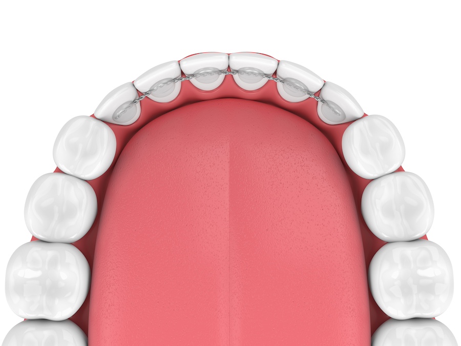 Emergency Dental of Omaha